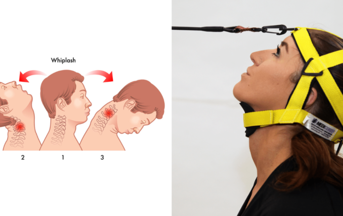 Strengthen the neck to prevent whiplash